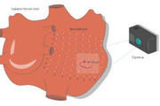 L'apprendimento automatico rileva i difetti cardiaci